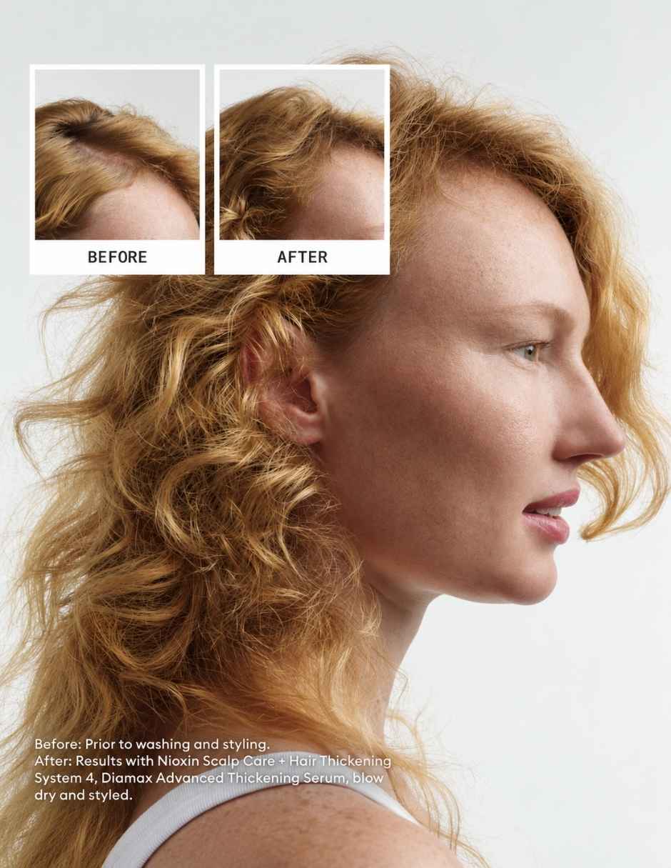 Tratamiento para cuero cabelludo sistema 4 para cabello decolorado con debilitamiento avanzado anticaída 2